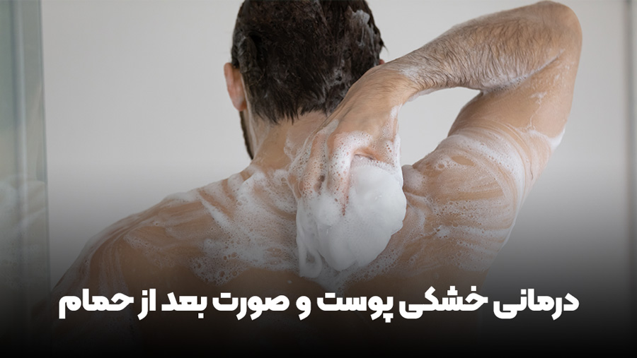 درمان خشکی پوست و صورت بعد از حمام کردن